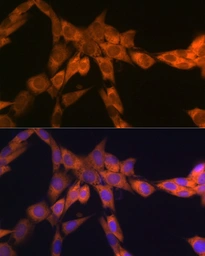 Anti-RPSA antibody [ARC2109] used in Immunocytochemistry/ Immunofluorescence (ICC/IF). GTX04348