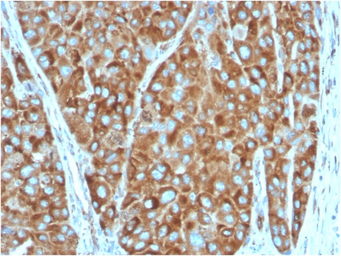 Anti-RPSA antibody [RPSA/2699] used in IHC (Paraffin sections) (IHC-P). GTX04349