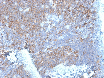 Anti-RPSA antibody [RPSA/2699] used in IHC (Paraffin sections) (IHC-P). GTX04349