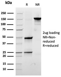 Anti-RPSA antibody [RPSA/2699] used in  (). GTX04349