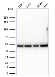 Anti-RPSA antibody [RPSA/2699] used in Western Blot (WB). GTX04349