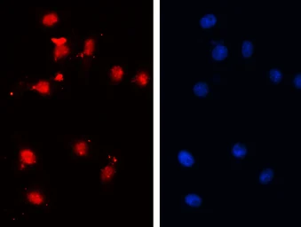 Anti-PAX7 antibody used in Immunocytochemistry/ Immunofluorescence (ICC/IF). GTX04358