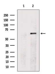 Anti-PAX7 antibody used in Western Blot (WB). GTX04358