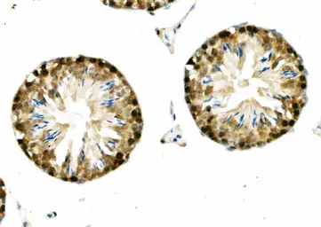 Anti-DNAJA2 antibody used in IHC (Paraffin sections) (IHC-P). GTX04359