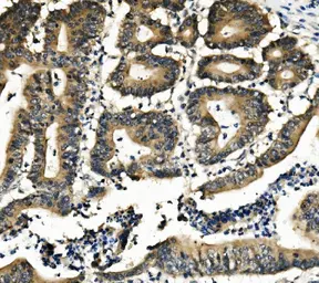 Anti-DNAJA2 antibody used in IHC (Paraffin sections) (IHC-P). GTX04359