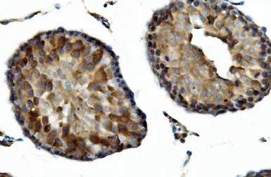 Anti-DNAJA2 antibody used in IHC (Paraffin sections) (IHC-P). GTX04359