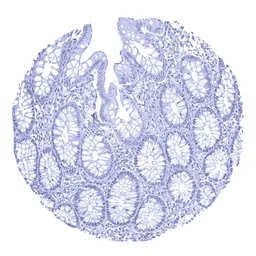 Anti-Androgen Receptor antibody [MSVA-367R] HistoMAX&trade; used in IHC (Paraffin sections) (IHC-P). GTX04368