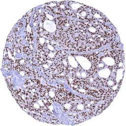 Anti-Androgen Receptor antibody [MSVA-367R] HistoMAX&trade; used in IHC (Paraffin sections) (IHC-P). GTX04368