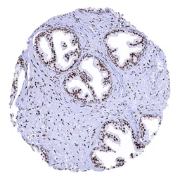 Anti-Androgen Receptor antibody [MSVA-367R] HistoMAX&trade; used in IHC (Paraffin sections) (IHC-P). GTX04368