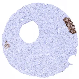 Anti-Chromogranin A antibody [MSVA-380R] HistoMAX&trade; used in IHC (Paraffin sections) (IHC-P). GTX04370