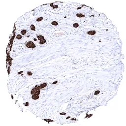 Anti-Chromogranin A antibody [MSVA-380R] HistoMAX&trade; used in IHC (Paraffin sections) (IHC-P). GTX04370