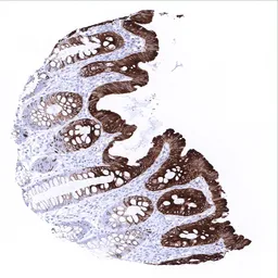 Anti-Cytokeratin 20 antibody [MSVA-620R] HistoMAX&trade; used in IHC (Paraffin sections) (IHC-P). GTX04376