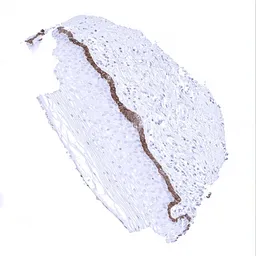 Anti-Cytokeratin 19 antibody [MSVA-119M] HistoMAX&trade; used in IHC (Paraffin sections) (IHC-P). GTX04378