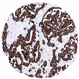Anti-Cytokeratin 19 antibody [MSVA-119M] HistoMAX&trade; used in IHC (Paraffin sections) (IHC-P). GTX04378