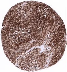 Anti-CD34 antibody [MSVA-034R] HistoMAX&trade; used in IHC (Paraffin sections) (IHC-P). GTX04386