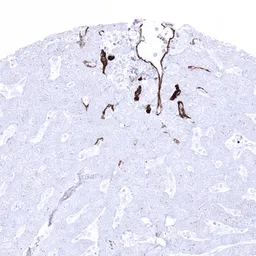 Anti-CD34 antibody [MSVA-034R] HistoMAX&trade; used in IHC (Paraffin sections) (IHC-P). GTX04386