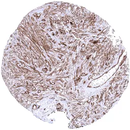 Anti-CD31 antibody [MSVA-031M] HistoMAX&trade; used in IHC (Paraffin sections) (IHC-P). GTX04395