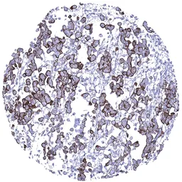 Anti-MUC1 antibody [MSVA-672R] HistoMAX&trade; used in IHC (Paraffin sections) (IHC-P). GTX04397