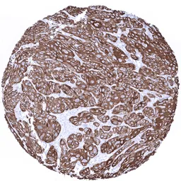 Anti-Cytokeratin 6 antibody [MSVA-606R] HistoMAX&trade; used in IHC (Paraffin sections) (IHC-P). GTX04403