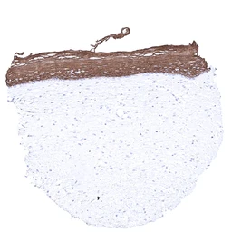 Anti-Cytokeratin 6 antibody [MSVA-606R] HistoMAX&trade; used in IHC (Paraffin sections) (IHC-P). GTX04403