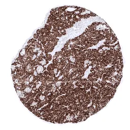 Anti-Parathyroid Hormone antibody [MSVA-525R] HistoMAX&trade; used in IHC (Paraffin sections) (IHC-P). GTX04405