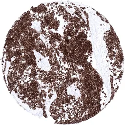 Anti-Desmin antibody [MSVA-651M] HistoMAX&trade; used in IHC (Paraffin sections) (IHC-P). GTX04410