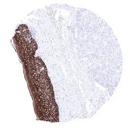 Anti-Cytokeratin 15 antibody [MSVA-615M] HistoMAX&trade; used in IHC (Paraffin sections) (IHC-P). GTX04411