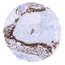 Anti-Cytokeratin 15 antibody [MSVA-615M] HistoMAX&trade; used in IHC (Paraffin sections) (IHC-P). GTX04411