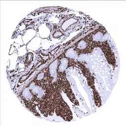 Anti-Vimentin antibody [MSVA-458R] HistoMAX&trade; used in IHC (Paraffin sections) (IHC-P). GTX04418