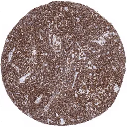 Anti-CD5 antibody [MSVA-005R] HistoMAX&trade; used in IHC (Paraffin sections) (IHC-P). GTX04427