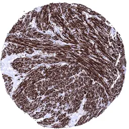 Anti-Caldesmon antibody [MSVA-538R] HistoMAX&trade; used in IHC (Paraffin sections) (IHC-P). GTX04451