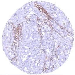 Anti-Decorin antibody [MSVA-537R] HistoMAX&trade; used in IHC (Paraffin sections) (IHC-P). GTX04463