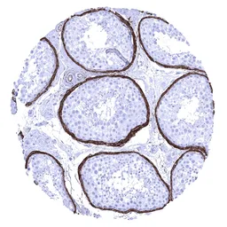 Anti-Elastin antibody [MSVA-648R] HistoMAX&trade; used in IHC (Paraffin sections) (IHC-P). GTX04466