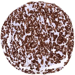 Anti-StAR antibody [MSVA-740R] HistoMAX&trade; used in IHC (Paraffin sections) (IHC-P). GTX04483