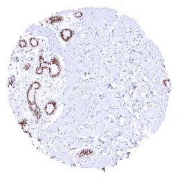 Anti-TRPS1 antibody [MSVA-512R] HistoMAX&trade; used in IHC (Paraffin sections) (IHC-P). GTX04485
