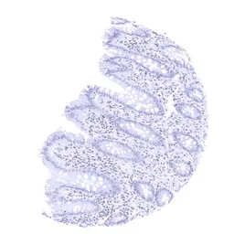 Anti-TRPS1 antibody [MSVA-512R] HistoMAX&trade; used in IHC (Paraffin sections) (IHC-P). GTX04485