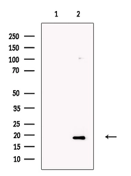 Anti-OMP antibody used in Western Blot (WB). GTX04493