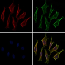 Anti-Vimentin antibody used in Immunocytochemistry/ Immunofluorescence (ICC/IF). GTX04497