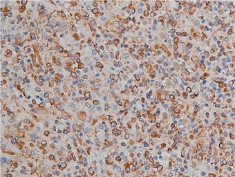 Anti-Vimentin antibody used in IHC (Paraffin sections) (IHC-P). GTX04497