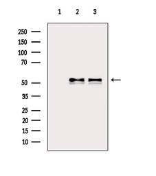 Anti-Vimentin antibody used in Western Blot (WB). GTX04497