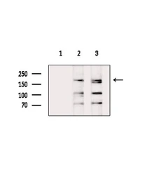 Anti-Fibronectin antibody used in Western Blot (WB). GTX04498