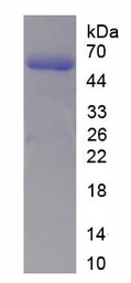 Human p53 protein, His tag. GTX04503-pro