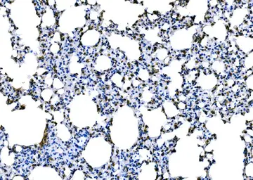 Anti-Dectin-1 antibody used in IHC (Paraffin sections) (IHC-P). GTX04506