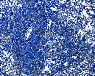 Anti-Dectin-1 antibody used in IHC (Paraffin sections) (IHC-P). GTX04506