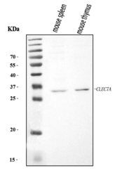 Anti-Dectin-1 antibody used in Western Blot (WB). GTX04506
