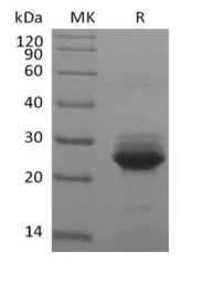 Human K-Ras (G12S mutant) protein, His tag. GTX04509-pro
