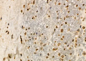Anti-NUR77 antibody used in IHC (Paraffin sections) (IHC-P). GTX04510