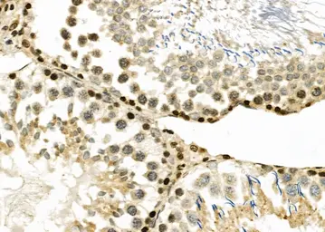 Anti-NUR77 antibody used in IHC (Paraffin sections) (IHC-P). GTX04510