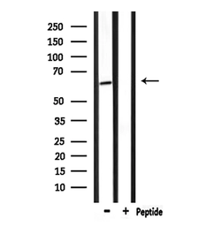 Anti-NUR77 antibody used in Western Blot (WB). GTX04510