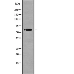 Anti-NUR77 antibody used in Western Blot (WB). GTX04510